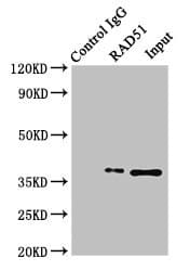 RAD51 / RECA Antibody