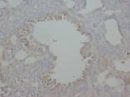 AGER / RAGE Antibody (N-Terminus)