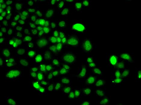 Polyclonal Rabbit anti-Human PIP4K2A / PIPK Antibody (IHC, IF, WB)