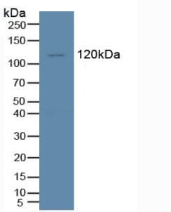 TIE1 / TIE Antibody