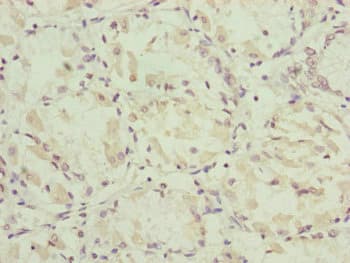 NDUFA12 / B17.2 Antibody
