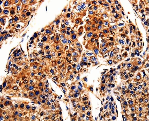 APLP1 / APLP-1 Antibody