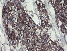 DPH2 Antibody (clone OTI3A12)