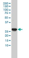 IHC-plus™ CA3 / Carbonic Anhydrase III Antibody (clone 4A12-1A3)