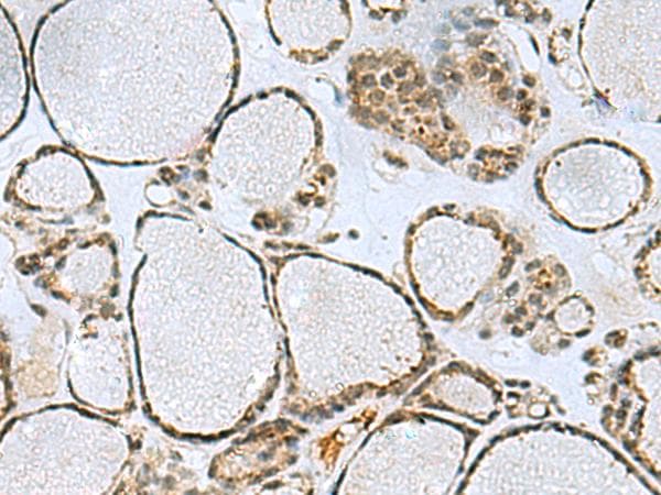 PPP2R4 Antibody