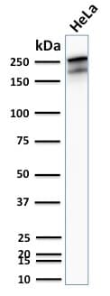 Recombinant Monoclonal Rabbit anti-Human SPTBN2 Antibody (clone SPTBN2/2894R, aa356-475, IHC, WB)