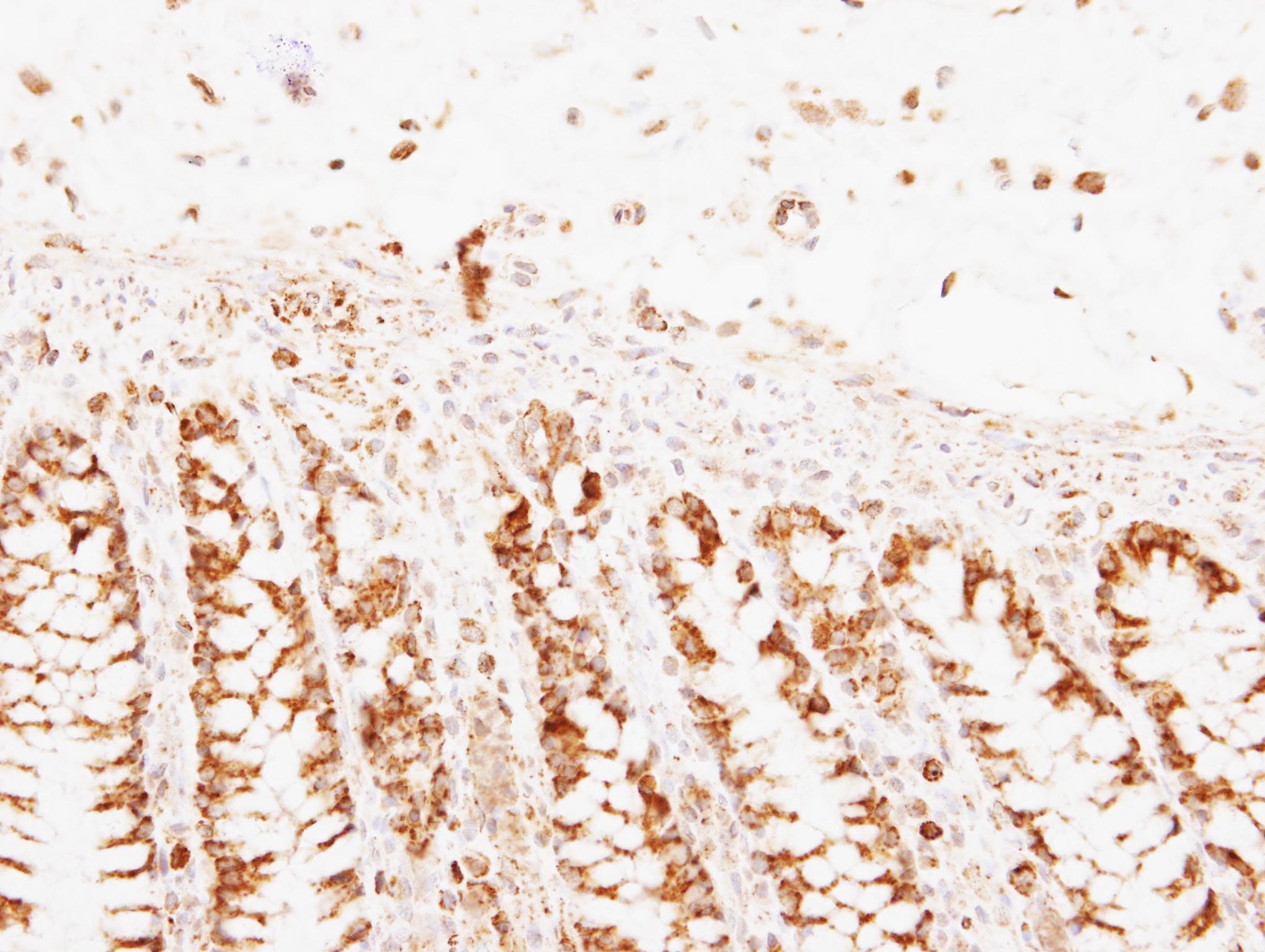 PNPT1 Antibody (aa1-783)