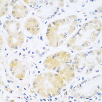 Polyclonal Rabbit anti-Human Complement C5 Antibody (IHC, WB)