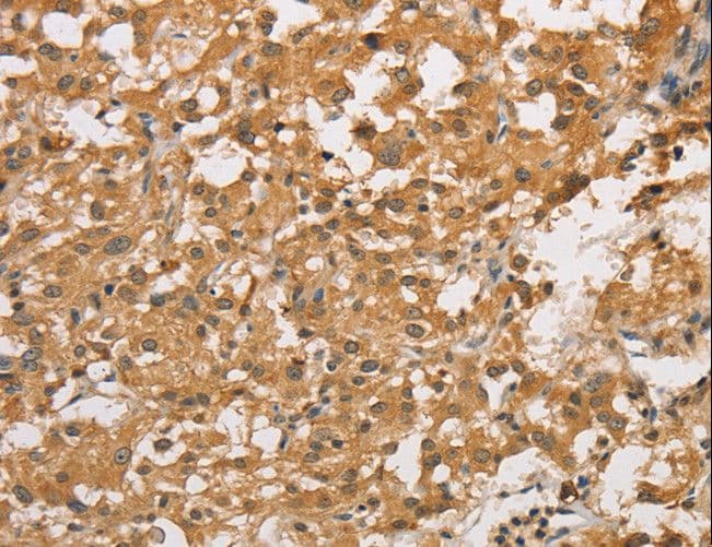 ARHGEF5 Antibody