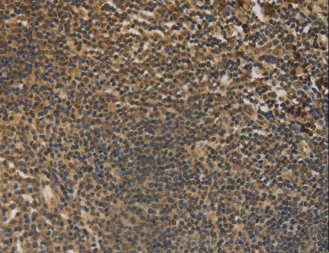 Polyclonal Rabbit anti-Human DACH / DACH1 Antibody (IHC)
