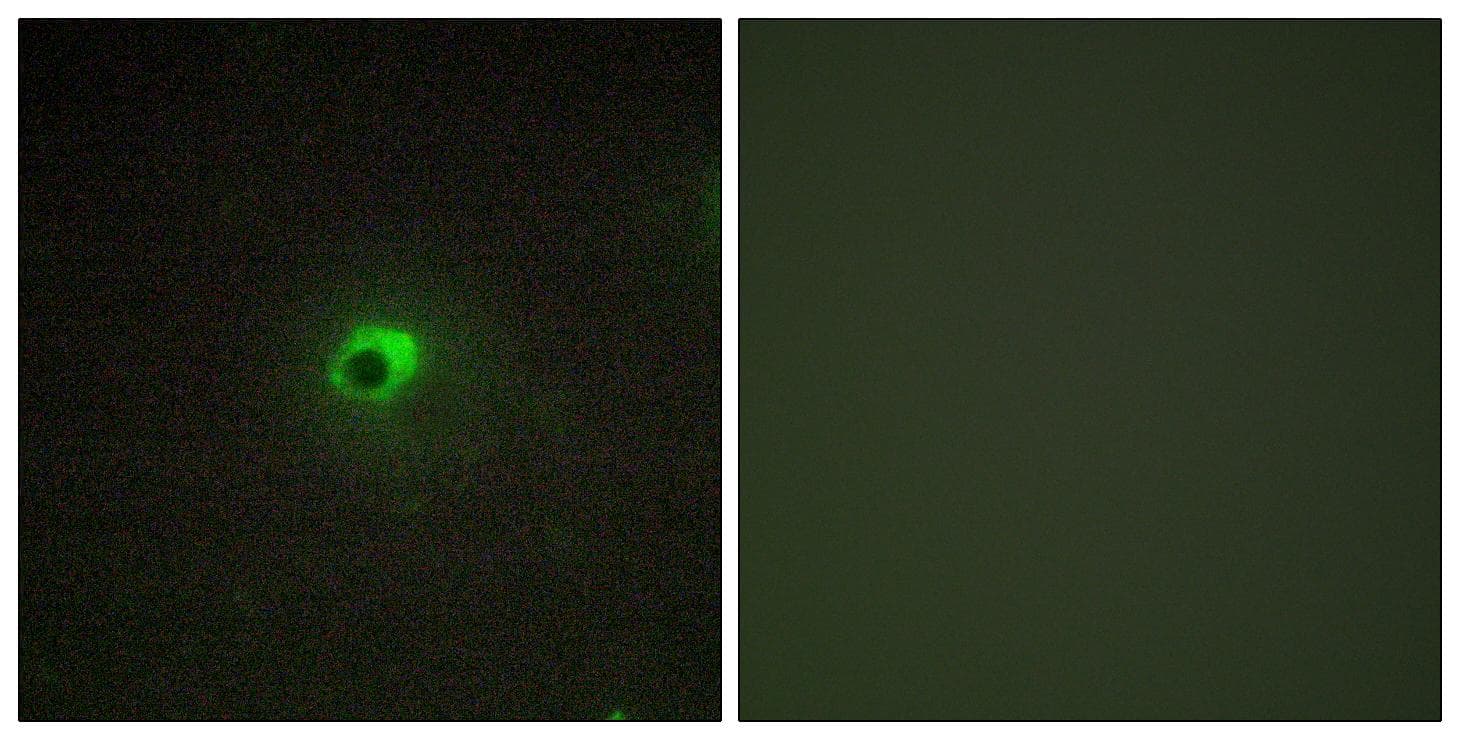 ACVR1C / ALK7 Antibody
