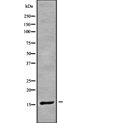 CRABP1 / CRABP Antibody
