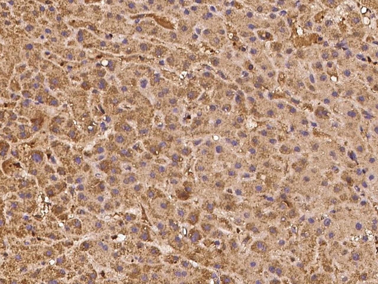 ASTL Antibody