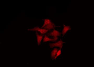 GPR107 / LUSTR1 Antibody