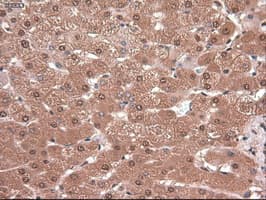 MYC / c-Myc Antibody (clone OTI3F2)