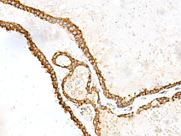 Polyclonal Rabbit anti-Human PDIA4 / ERP72 Antibody (IHC, WB)