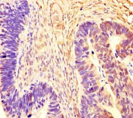 Polyclonal Rabbit anti-Human RCOR1 / COREST Antibody (IHC)