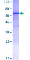 Human SERPINB3 Protein (Recombinant GST)