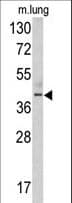 Polyclonal Rabbit anti-Human TDG / Thymine DNA Glycosylase Antibody (aa81-110, WB)