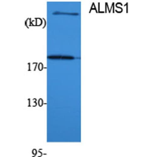 Polyclonal Rabbit anti-Human ALMS1 Antibody (1530-1610 aa, Internal, IHC, WB)