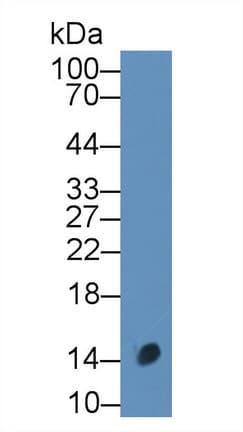 CALCB Antibody (aa1-134)
