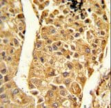CYP2C18 / CYP2C Antibody (aa448-478)