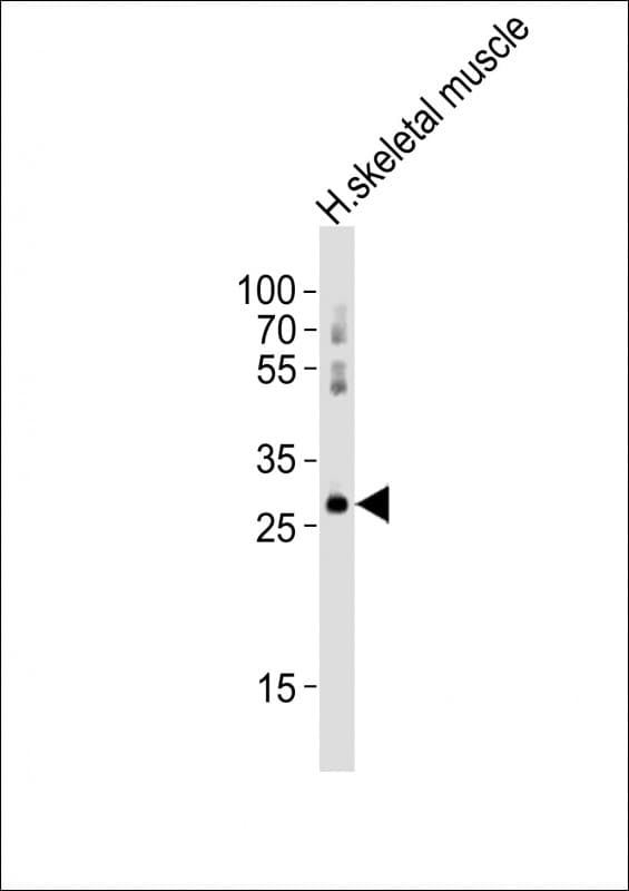 HOXB1 Antibody (aa182-315)