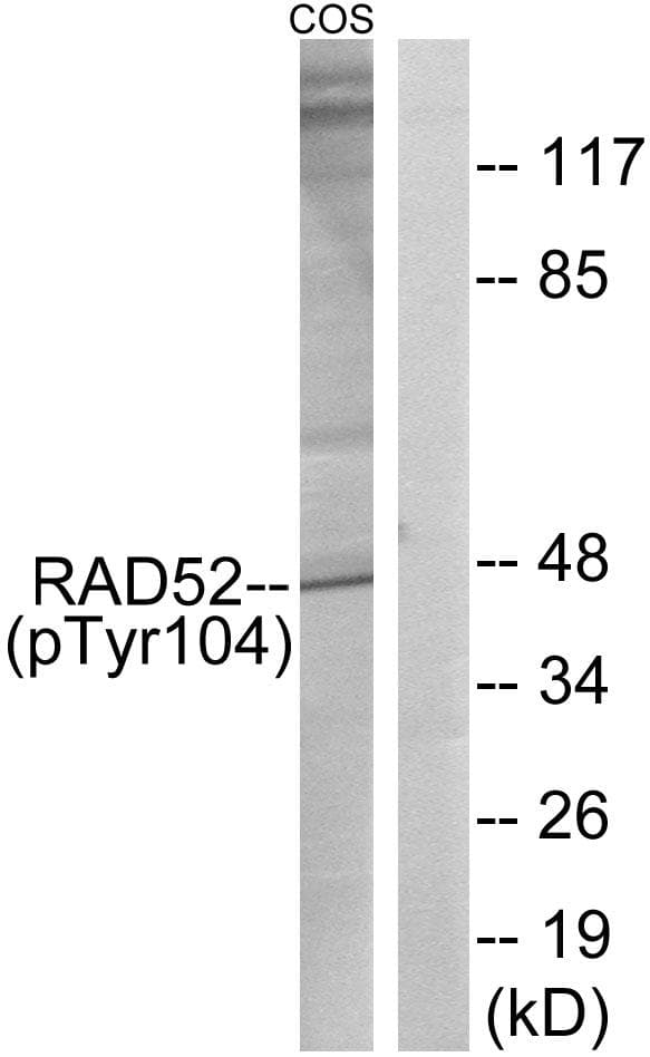 RAD52 Antibody (phospho-Tyr104)