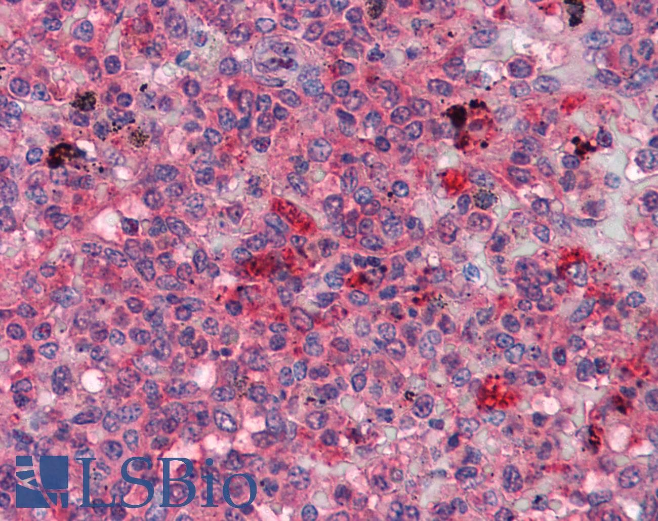IHC-plus™ Monoclonal Mouse anti-Human FGR Antibody (clone 6G2, IHC, WB)