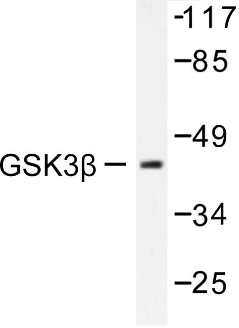 Polyclonal Rabbit anti-Human GSK3B / GSK3 Beta Antibody (Ser2, IHC, WB)