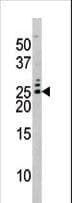 BAD Antibody (phospho-Ser75)