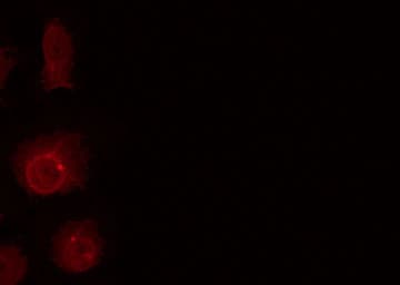 NBN / Nibrin Antibody (phospho-Ser278)