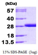 Schistosoma japonicum GST / Glutathione S-Transferase Protein (Recombinant His)