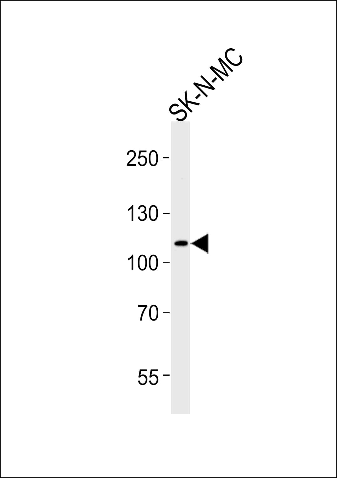 Polyclonal Rabbit anti-Human NOC3L Antibody (aa49-78, WB)