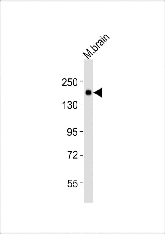 JAG1 / Jagged 1 Antibody (aa1191-1224)