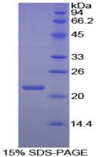 Chicken IL2 Protein (Recombinant His-S)