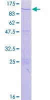 Human ZNF84 Protein (Recombinant GST)