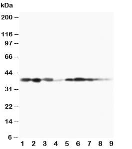 MAP2K3 / MEK3 / MKK3 Antibody (aa320-334)