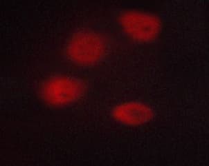 Polyclonal Rabbit anti-Human HDAC3 Antibody (phospho-Ser424, IHC, IF, WB)