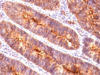 EMA / MUC1 Antibody (clone MUC1/845)