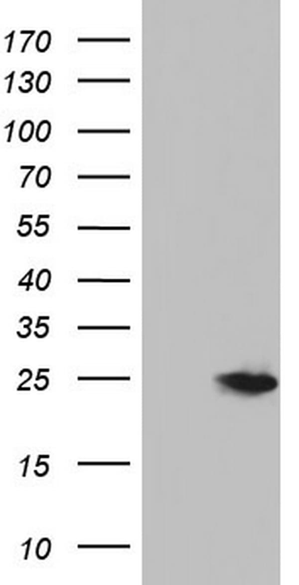 NUDT10 Antibody (clone OTI1A6)