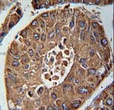 Polyclonal Rabbit anti-Human SDHAF3 / ACN9 Antibody (aa13-42, IHC, WB)