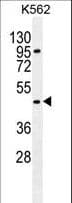 Polyclonal Rabbit anti-Human CPA3 Antibody (aa255-284, WB)