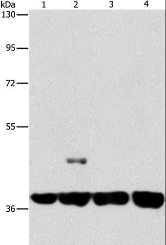 SERPINA9 Antibody
