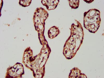Polyclonal Rabbit anti-Human RAB11FIP5 / RIP11 Antibody (IHC)