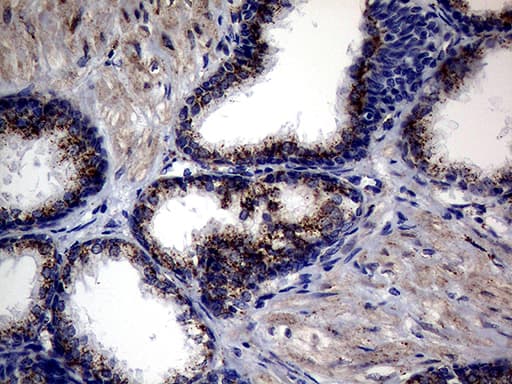 Monoclonal Mouse anti-Human CTSL / Cathepsin L Antibody (clone OTI2H2, IHC, WB)