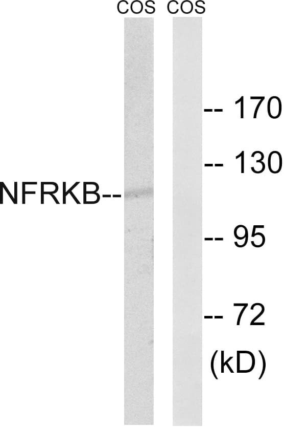 Polyclonal Rabbit anti-Human NFRKB Antibody (aa463-512, WB)