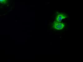 BRAF / B-Raf Antibody (clone OTI3A7)