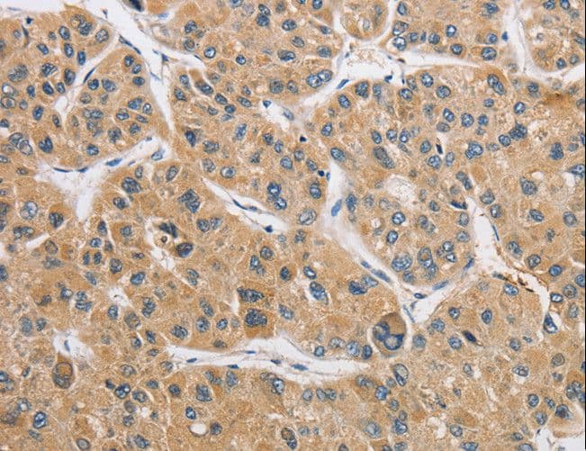 ARHGAP15 Antibody