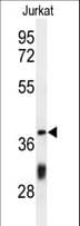 Polyclonal Rabbit anti-Human CCDC130 Antibody (aa173-200, IHC, WB)